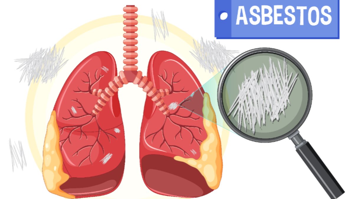 Gestione dell’amianto sul lavoro: diffuse le linee guida UE